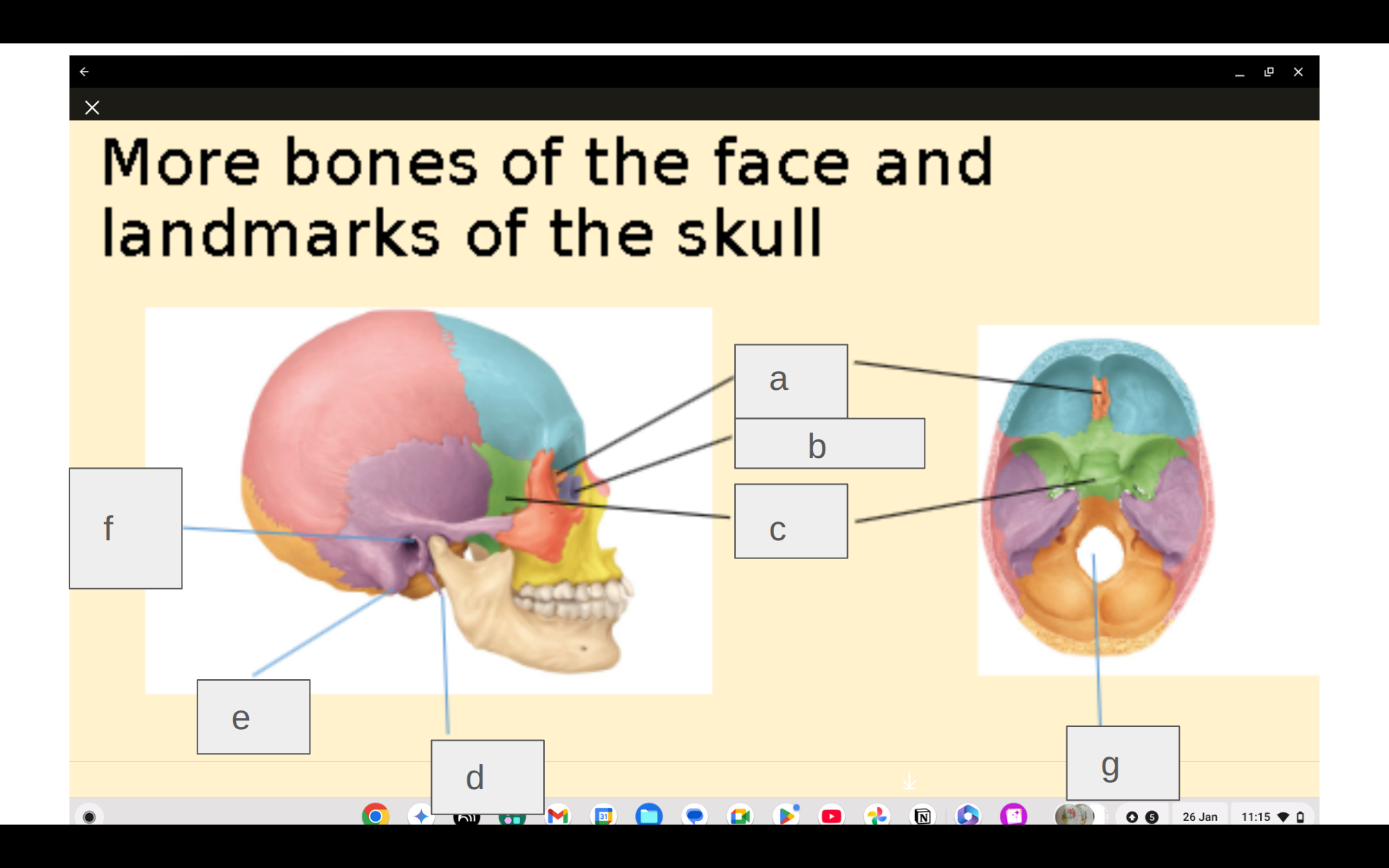 <p>Where is the ethmoid bone?</p>