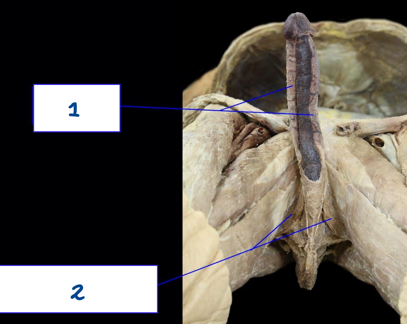 <p>What is structure 2?</p>