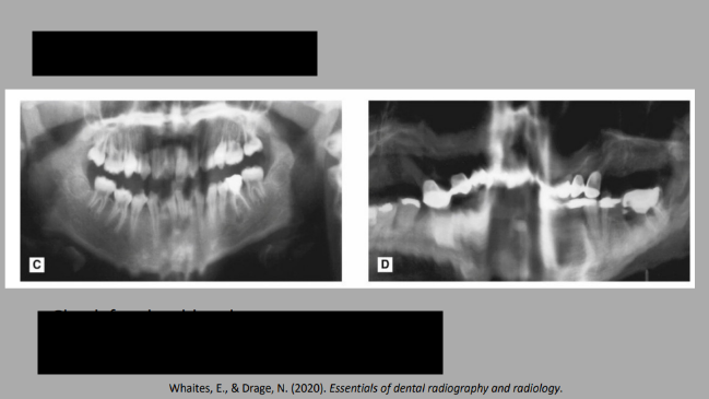 <p>What error is this?</p>