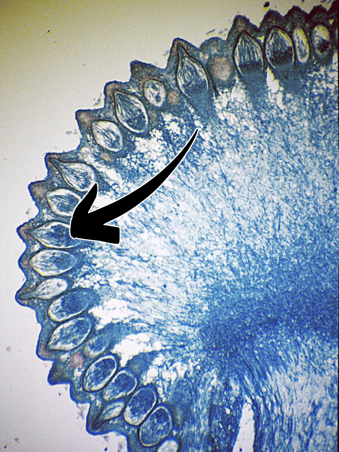 <p>Claviceps purpurea: Vad indikerar pilen på för struktur?</p>