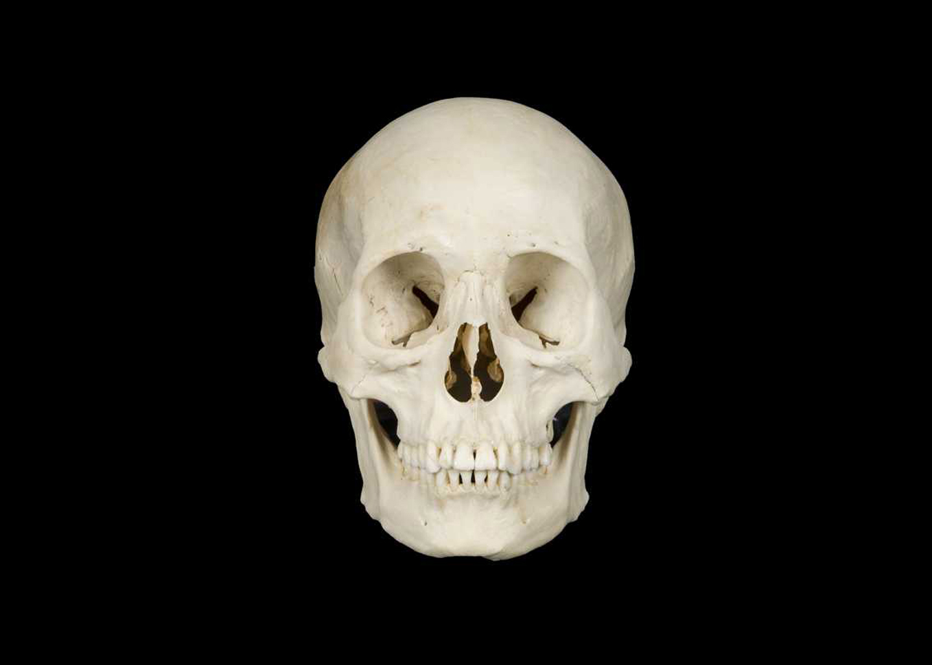 <p>Bone in nose </p>