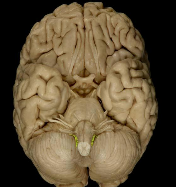 <p>List the nerve name, roman numeral, and function.</p>
