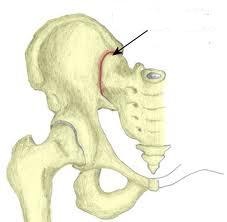 The articulation of sacrum and ilium (gliding)