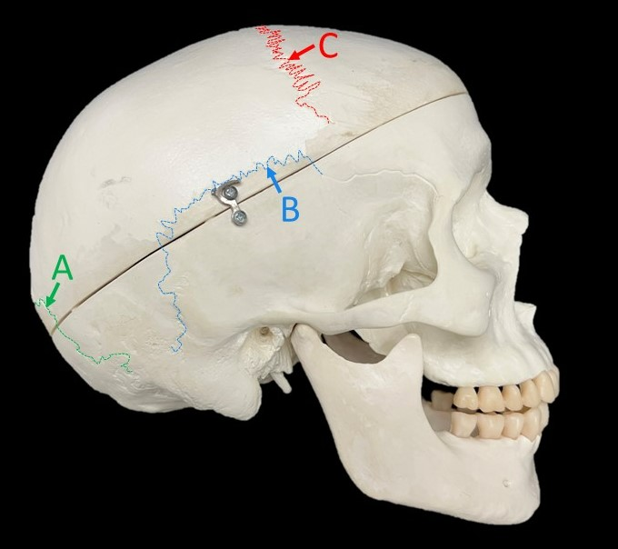 <p>Identify the structure labeled C. </p>