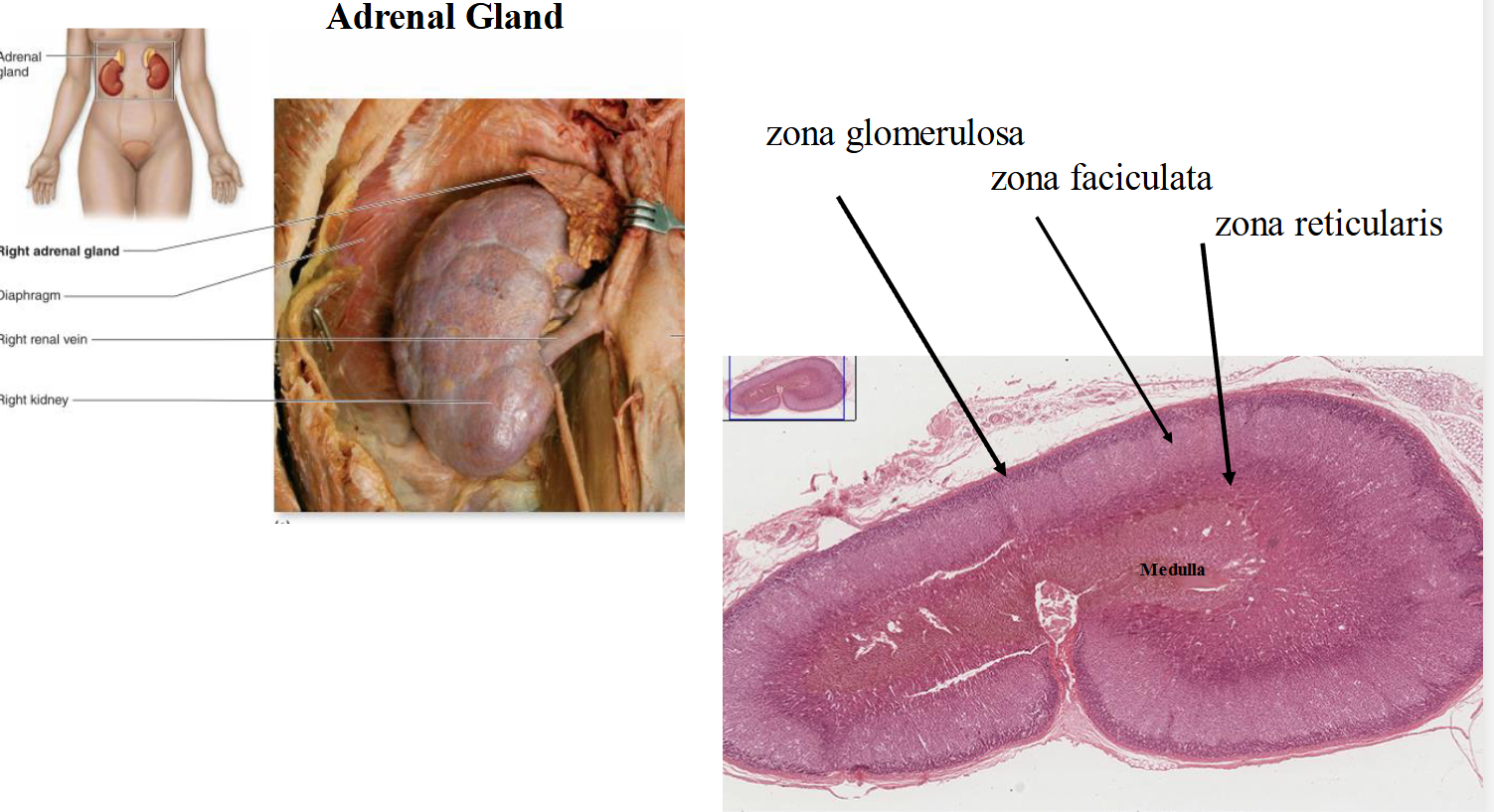 <p>adrenal gland</p>
