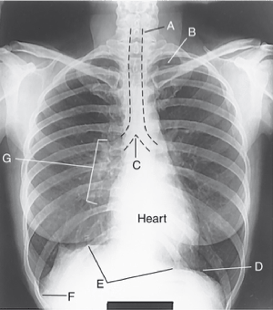 <p>Label: C</p>