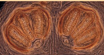 <p>This spiracle belongs to which fly larvae?</p>