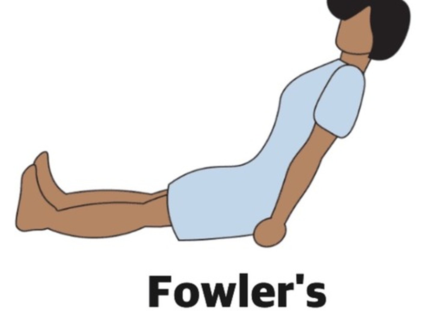 <p>Fowlers</p>