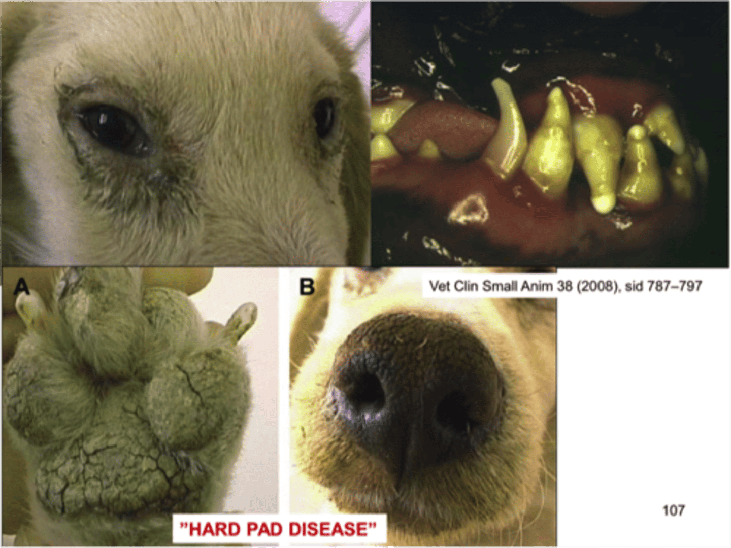 <p>💉Family: Paramyxoviridae (Morbillivirus)</p><p>Disease: Canine Distemper</p><p>Systems: Respiratory, GI, nervous, integumentary, lymphoid</p><p>⚠️Clinical Signs: Fever, nasal/ocular discharge, cough, vomiting, diarrhoea, seizures, ataxia, myoclonus, hyperkeratosis of footpads ("hard pad disease")</p><p>🔬Histopathology: Intranuclear &amp; intracytoplasmic inclusion bodies, lymphoid necrosis, demyelination in CNS</p>