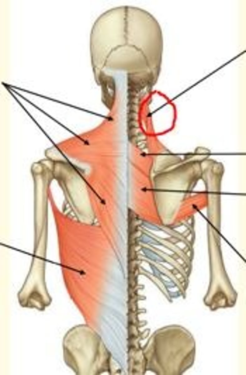 <p>Levator Scapulae</p><p>- Elevates & rotates scpula</p><p>- Innervated by dorsal scapula nerve & C3-4</p>