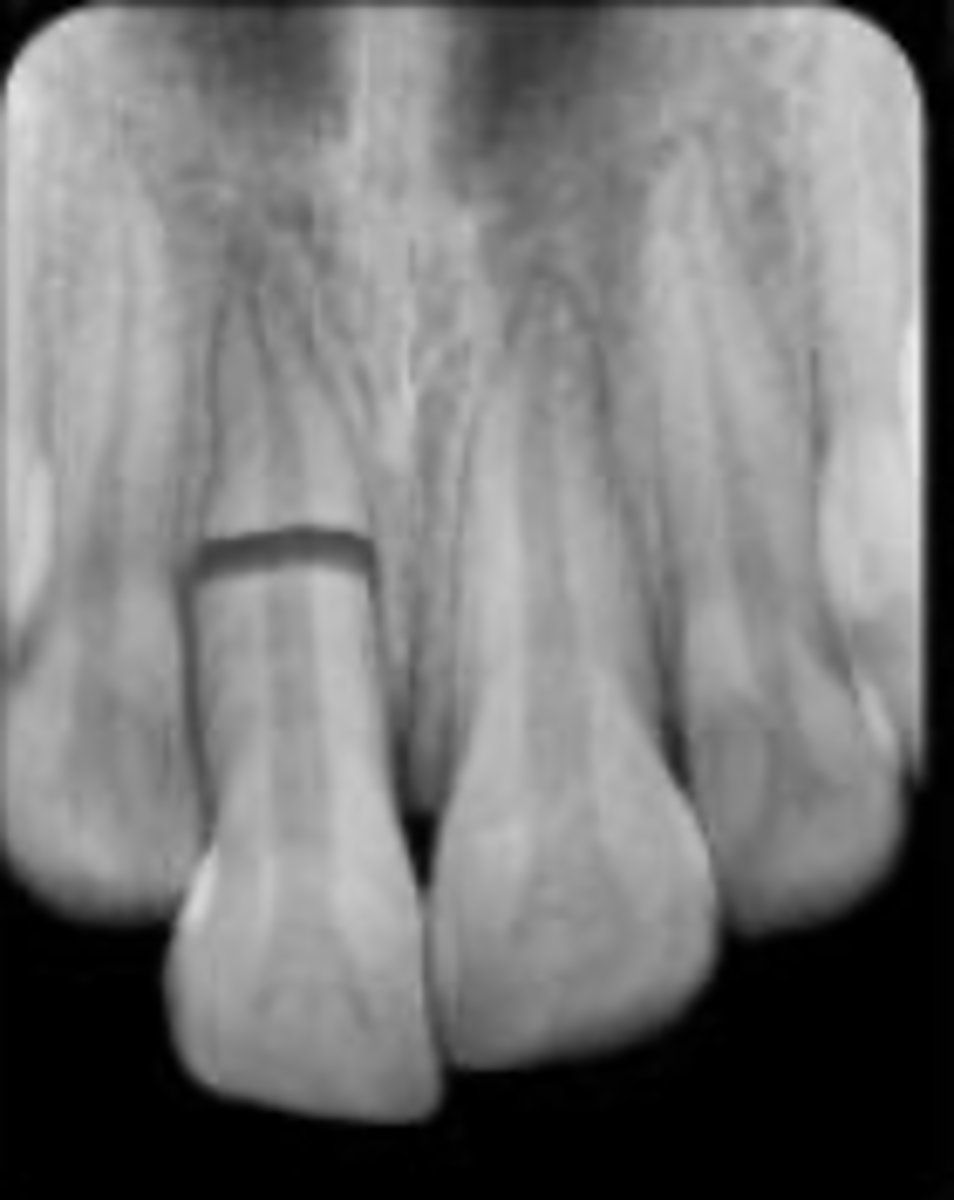 <p>Which trauma:</p>