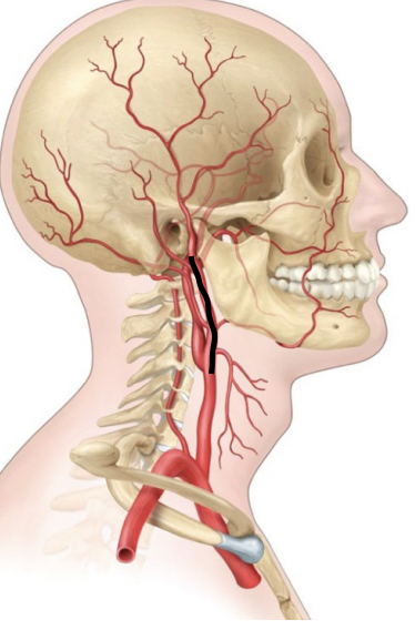 <p>A branch of the carotid artery that supplies blood to the face and scalp.</p>