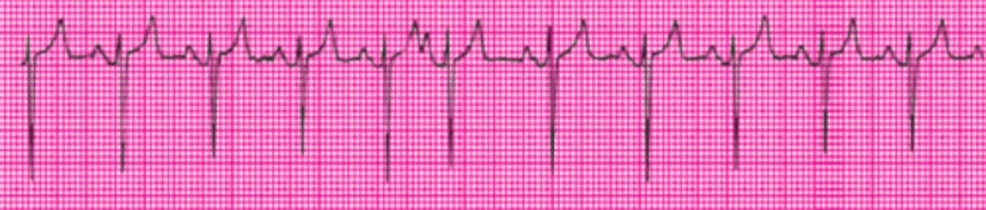 <p>Name this rhythm.</p>