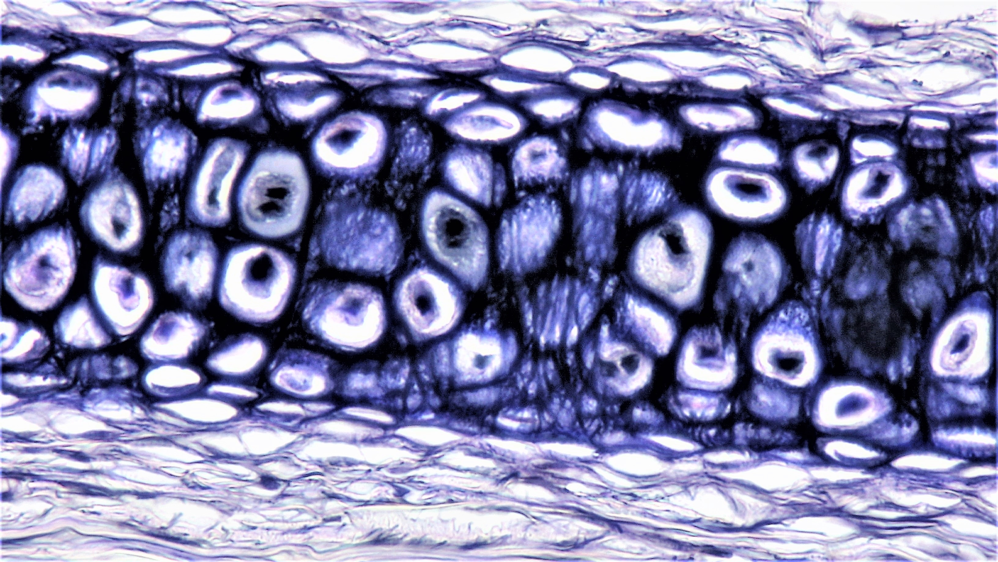 <p>Is this fibrocartilage, hyaline cartilage, or elastic cartilage?</p>