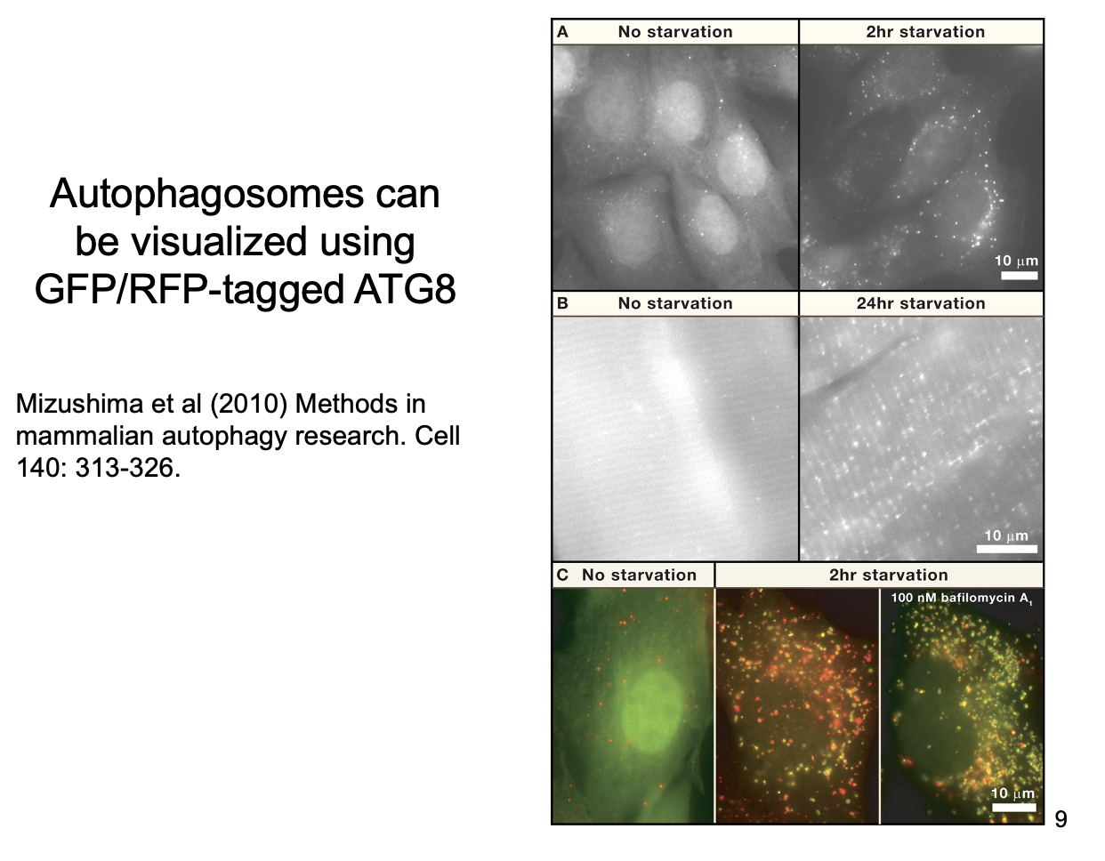 <p>What are the steps in Autophagy</p>