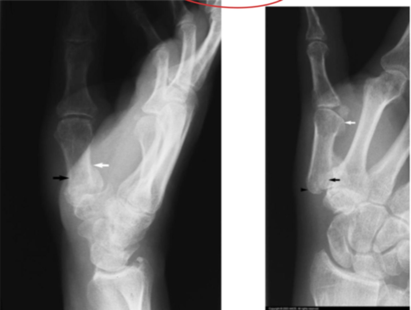 <p>What is the issue?</p>