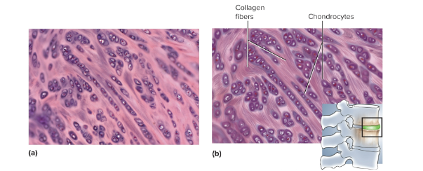 <p>Fibrocartilage</p>