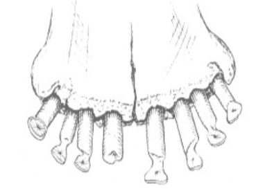 term image