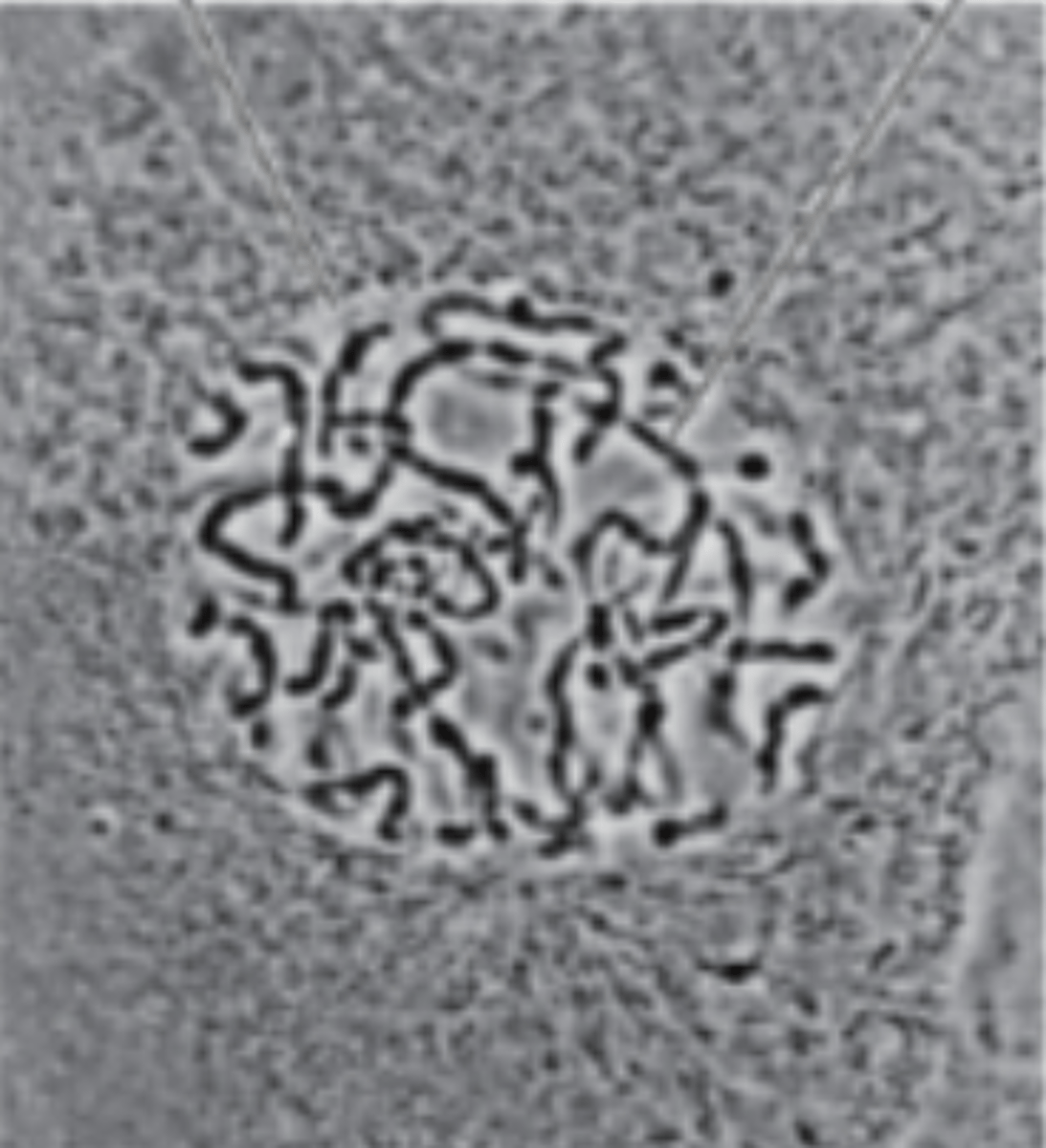 <p>What are the black lines in the nucleus?</p>