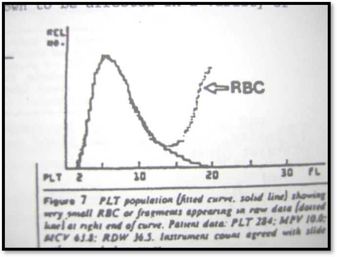 microcytic or fragmented RBCs

MCV 63 fl

RDW 36.5%