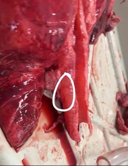 <p>What structure/cartilage of the lungs is this?</p>