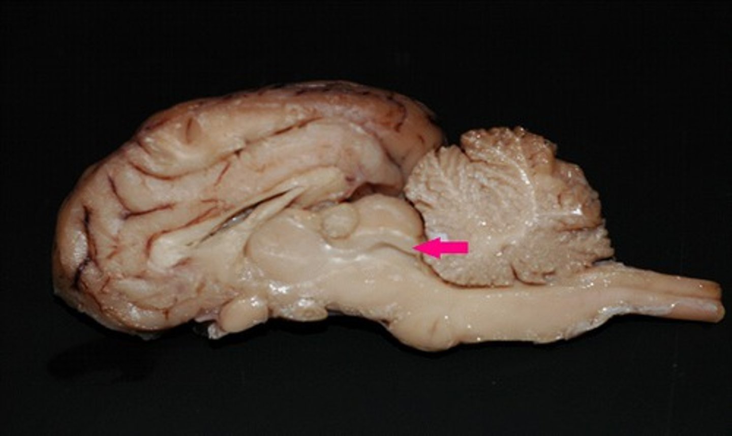 <p>Identify the structure.</p>