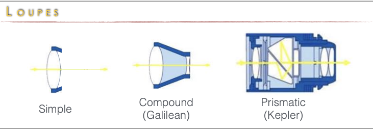 <ul><li><p>simple</p></li><li><p>Compound (Galilean) - 2 lens one convex and one concave</p></li><li><p>Prismatic (Kepler) - multiple convex lenses</p></li></ul><p></p>