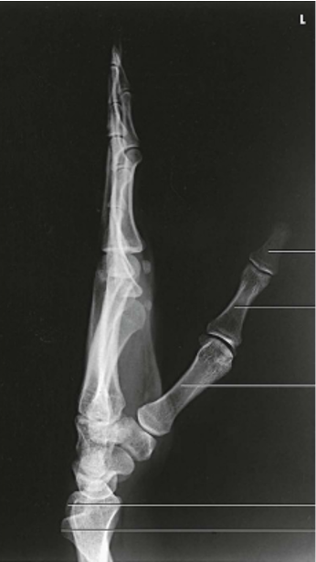<p></p>