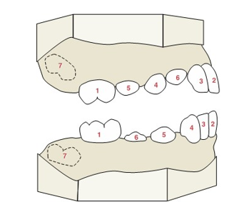 <ul><li><p>first molars (6-7 years)</p></li><li><p>2. lower central incisor (6-7)</p></li><li><p>2. upper central incisor (7-8)</p></li><li><p>3. lower lateral incisor (7-8)</p></li><li><p>3. upper lateral incisor (8-9)</p></li><li><p>4. lower canine (9-10)</p></li><li><p>4. upper first premolar (10-11)</p></li><li><p>5. lower first premolar (10-12)</p></li><li><p>5. upper second premolar (10-12)</p></li><li><p>6. upper canine (11-12)</p></li><li><p>6. lower second premolar (11-12)</p></li><li><p>7. second molar (11-13)</p></li><li><p>8. third molar (17-21)</p></li></ul><p>W 12 6       6 12 W</p><p>W 12 6       6 12 W</p><p></p>