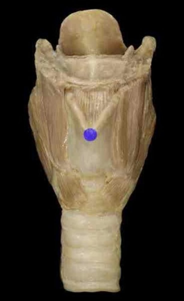 <p><em>identify the structure:</em></p>