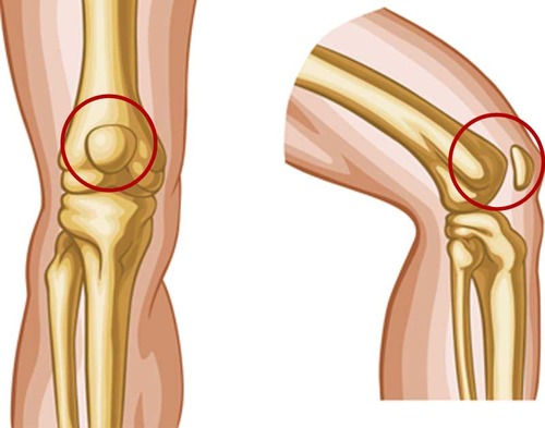 Articulation of the femur and patella (gliding)