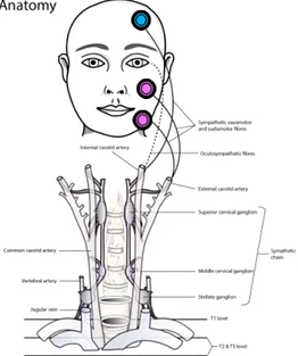 <p>internal maxillary branch of the ECA</p>
