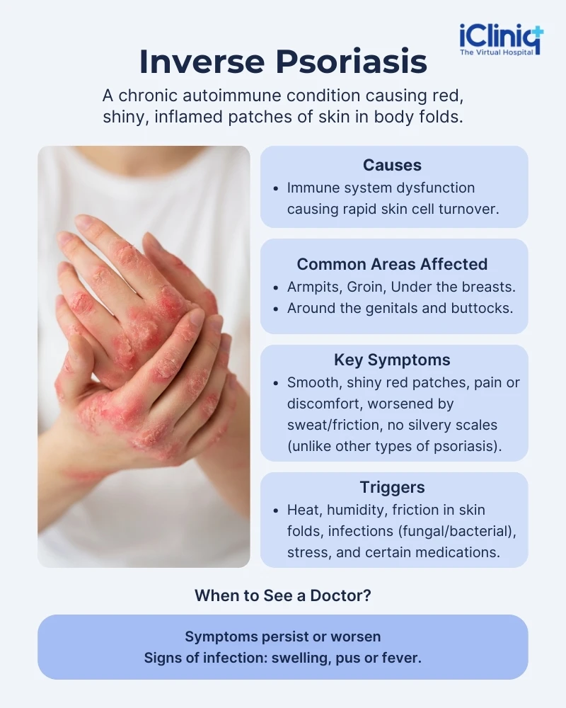 <p>PP: psoriasis under folds</p><p>E: folds<br>-ears<br>-axillae<br>-groin<br>-intergluteal crease<br>-penis</p><p>CM: mimics candida infection</p><p>Dx: KOH→negative</p><p>TX:<br><u>topical:</u><br><strong>1st line→topical steroids</strong><br>topical calcipotriene<br>anthralin+coal tar<br>narrow band UV x 3x/week</p><p><u>systemic:</u><br>methotrexate<br>acute→cyclosporine+taper off<br>PO acitretin<br>apremilast</p><p><u>Biologics:</u><br><strong>TNF alpha inhibitors:</strong><br>-entanercept<br>-adalimumab</p><p><strong>interleukin 12+23 inhibitor:</strong><br>-ustekinumab</p><p><strong>interleukin 17 inhibitors:</strong><br>-ixekizumab<br>-secukinumab</p><p><strong>interleukin 23 inhibitor:</strong><br>-guselkumab<br>-risankizumab<br>-tildrakizumab</p>