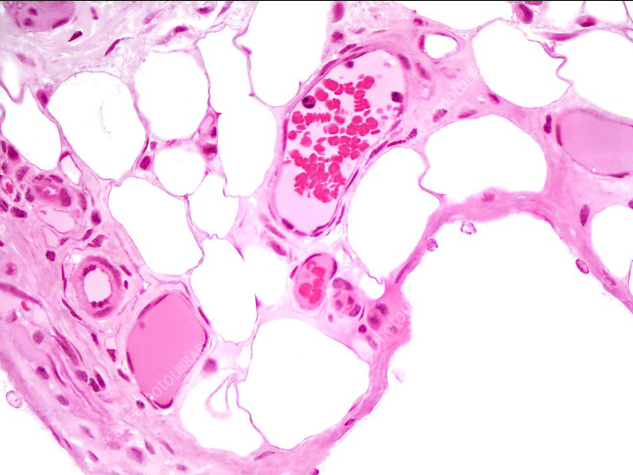 <p>what are 3 layers of blood vessels?</p>