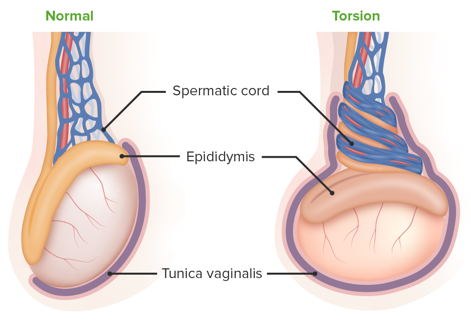 la ________ es una parte del testiculo que deriva del peritoneo que se forma durante el descenso de los testiculos