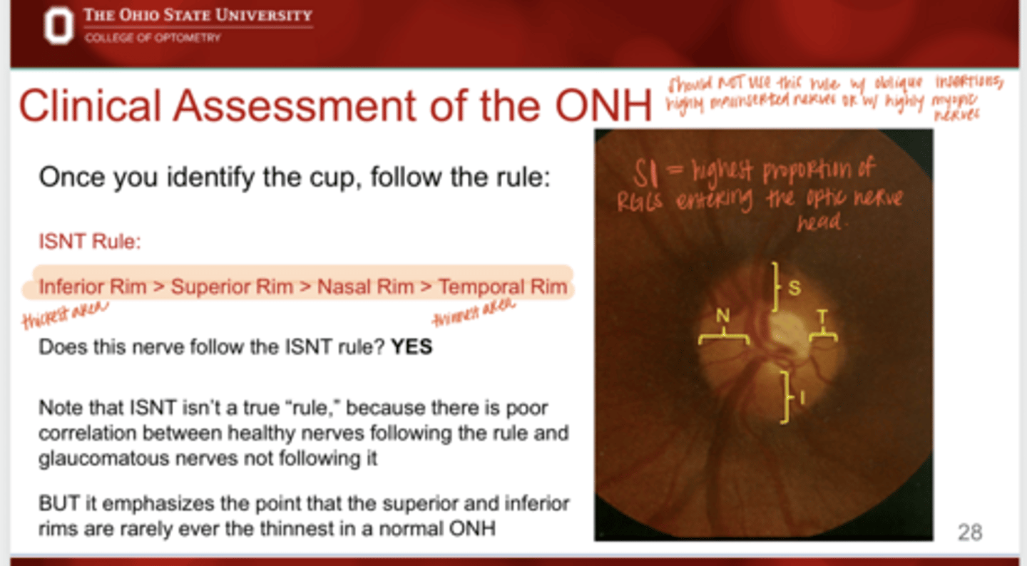 <p>Is the ISNT rule a true rule? What is the main purpose of the rule?</p>