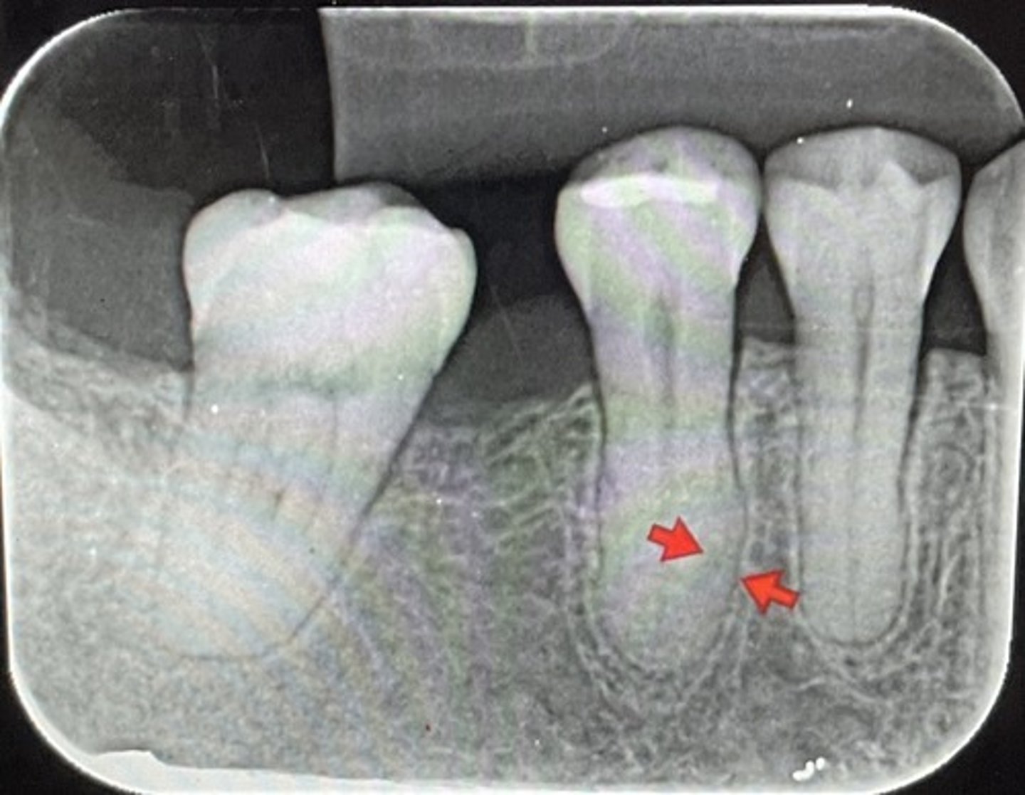 <p>What are the red arrows representing?</p>