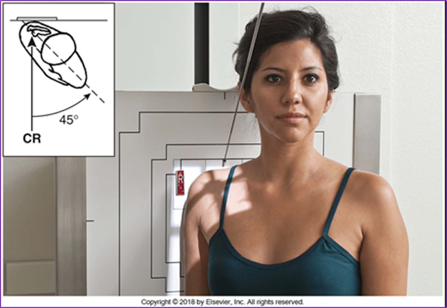 <p>CR angled 45° caudal to scapulohumeral joint, patient rotated 45° to affected side (this is a trauma projection!)</p>