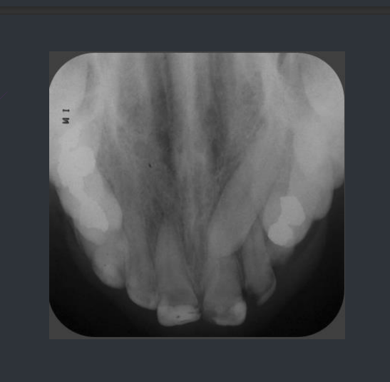 <p>What type of radiograph is this?</p>