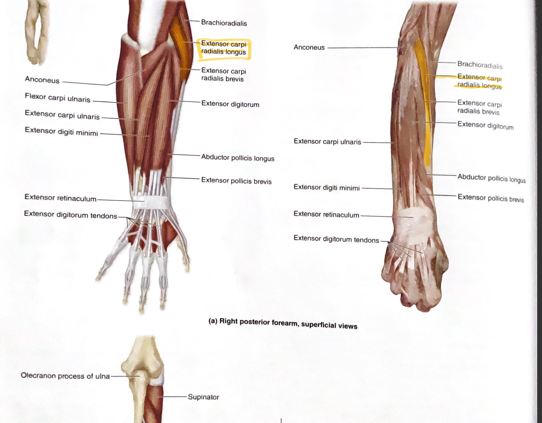 <p>Action:Extend, abduct wrist</p>