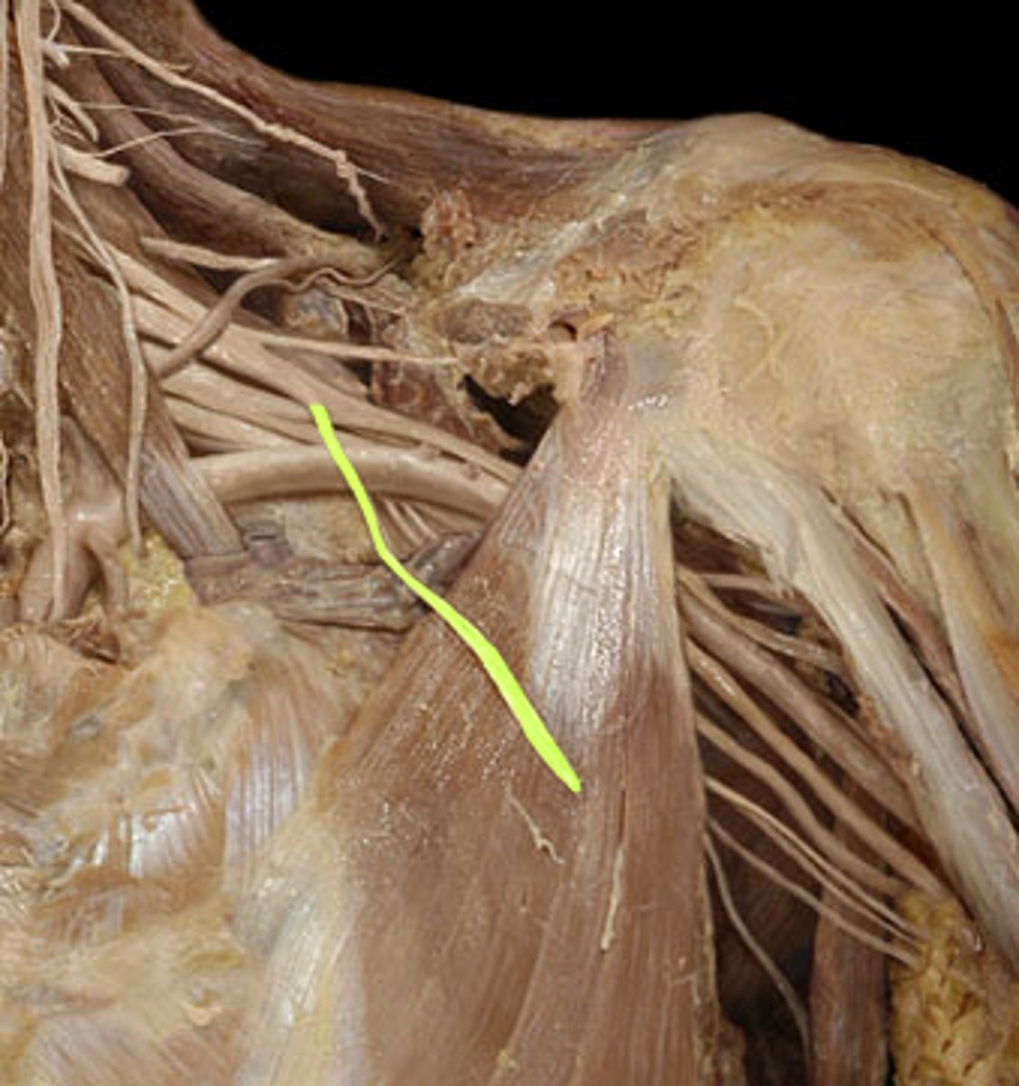 <p>What is this nerve?</p>