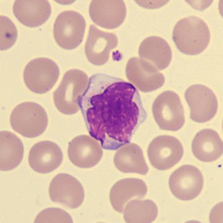 <p>What is this leukocyte?</p>