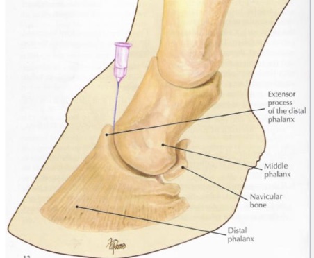 <p>what is desensitized in distal interphalangeal joint</p>