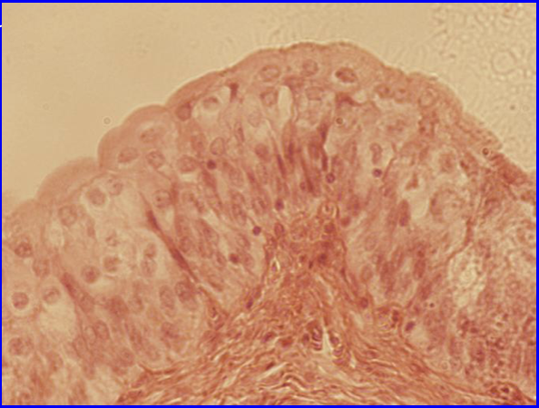 term image