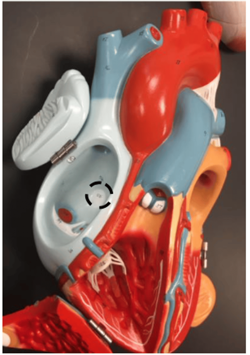 <p>depression on the right atrium</p>