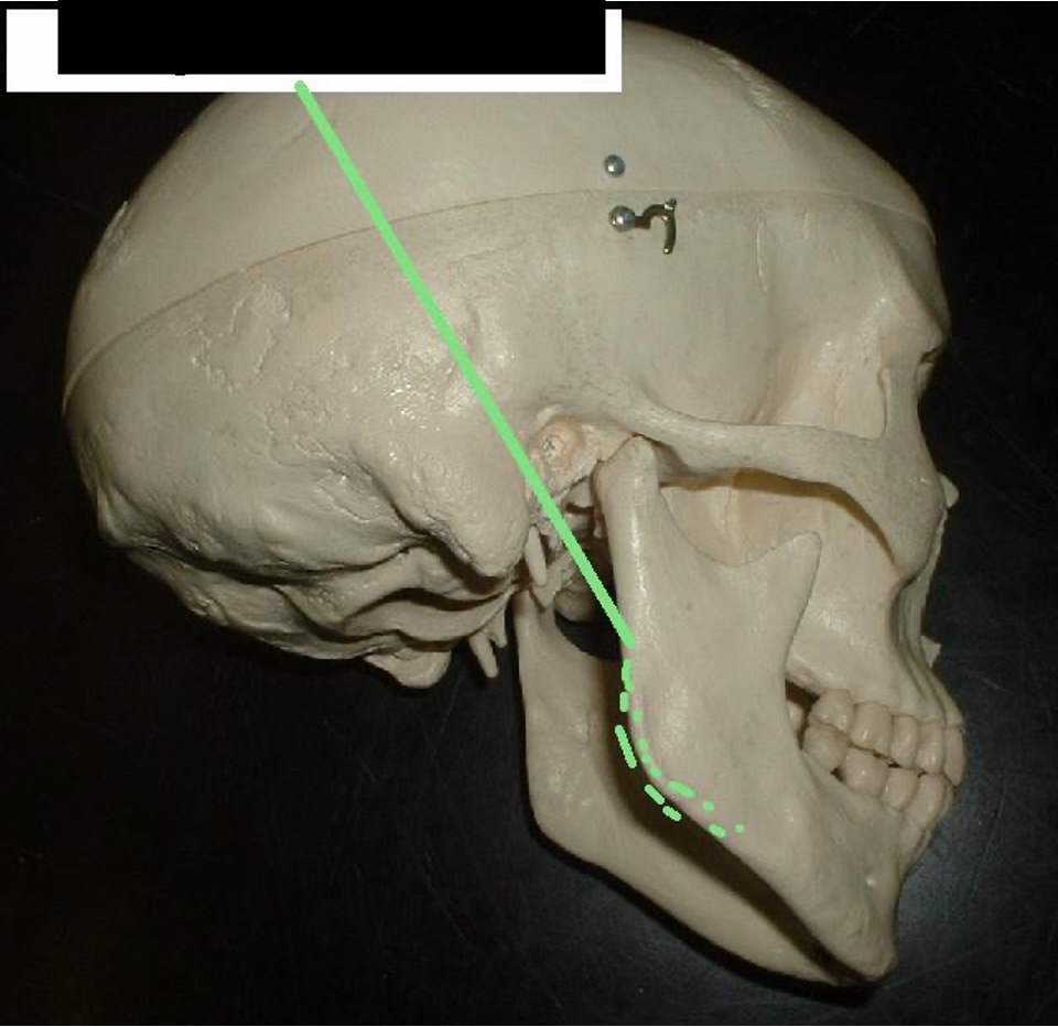 <p>The jawline (where the jaw changes directions)</p>