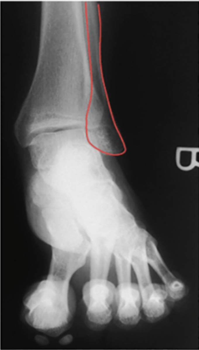 <p>What structure is highlighted?</p>
