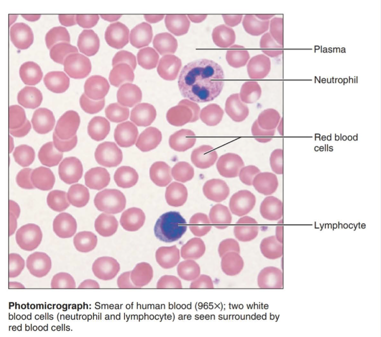 <p>A connective tissue with a fluid matrix called plasma in which red blood cells, white blood cells, and cell fragments called platelets are suspended.</p>