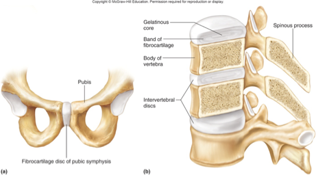 <p>cartilagenous</p><ul><li><p>pad of FIBROUS cartilage between bones</p><ul><li><p>toughest cartilage - absorbs shock when walking/running</p></li></ul></li><li><p>amphiarthrotic</p></li><li><p>pubic symphysis &amp; intervertebral discs</p></li></ul><p></p>