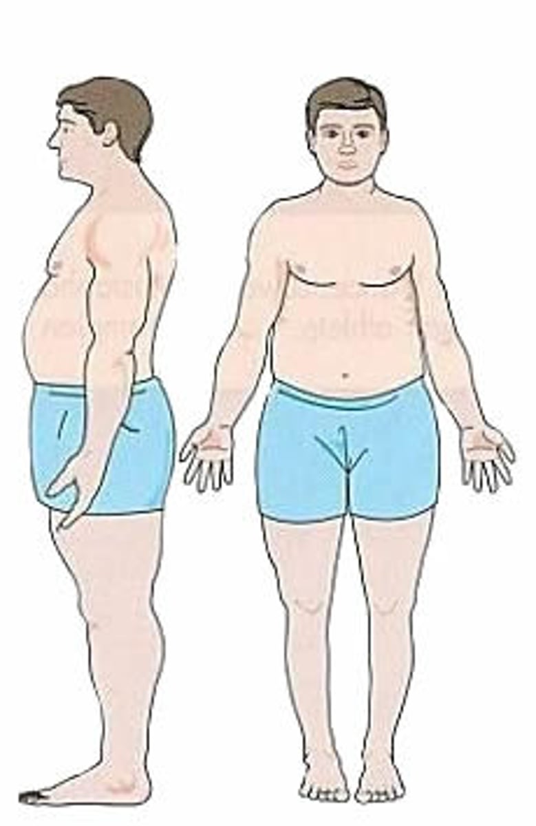 <p>Wide hips,</p><p>Large amounts of body fat</p><p>shorter limbs</p><p>Thick ribcage</p><p>Good at rugby as a prop/forward</p>